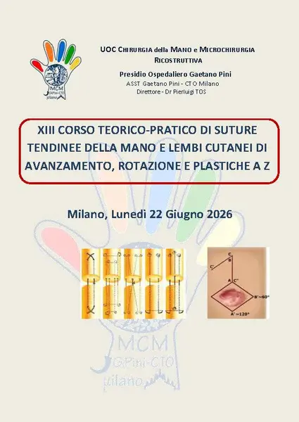 XIII Corso teorico-pratico di suture tendinee della mano e lembi cutanei di avanzamento, rotazione e plastiche a Z XIII Corso teorico-pratico di suture tendinee della mano e lembi cutanei di avanzamento, rotazione e plastiche a Z